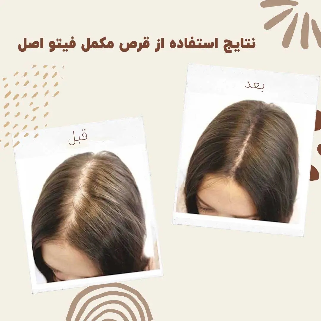قرص تقویت مو و ناخن فیتو 120 عددی ا Phyto Phanere Hair and Nail(اورجینال اروپایی)