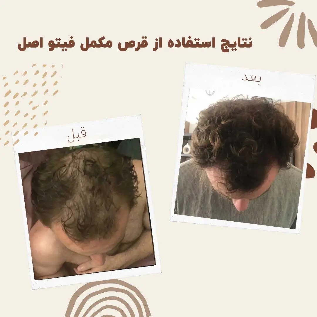 قرص تقویت مو و ناخن فیتو 120 عددی ا Phyto Phanere Hair and Nail(اورجینال اروپایی)